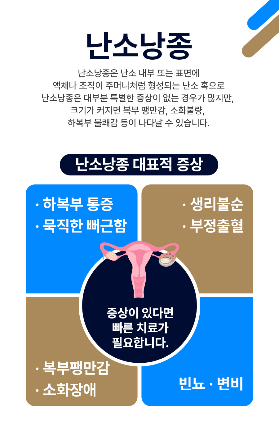 난소낭종 원인 설명